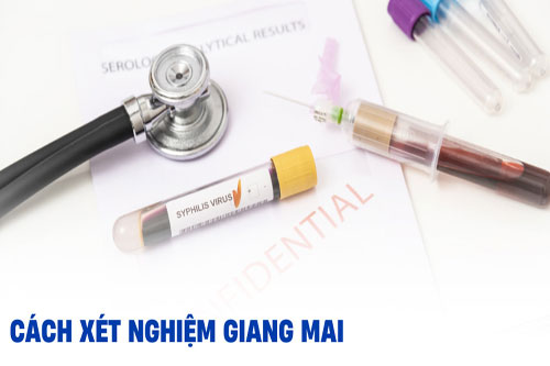 8 cách xét nghiệm bệnh giang mai nhanh chóng chính xác