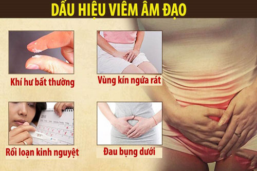 Triệu chứng viêm âm đạo