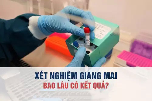 Xét nghiệm giang mai bao lâu là chính xác kết quả