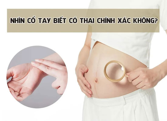 Nhìn cổ tay biết có thai đúng không