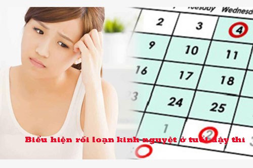 Biểu hiện rối loạn kinh nguyệt ở tuổi dậy thì