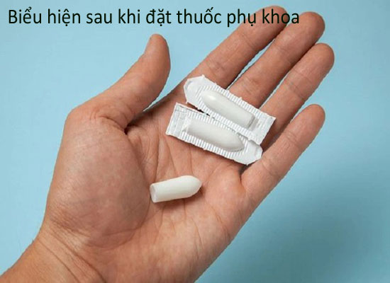 Biểu hiện sau khi đặt thuốc phụ khoa
