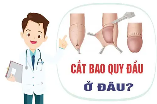 18 địa chỉ cắt bao quy đầu ở đâu tốt nhất an toàn tại Hà Nội