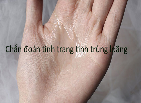 Chẩn đoán tình trạng tinh trùng loãng