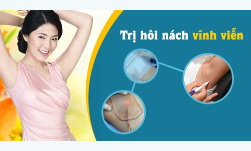 20 Cách chữa trị bệnh hôi nách vĩnh viễn tận gốc tại nhà