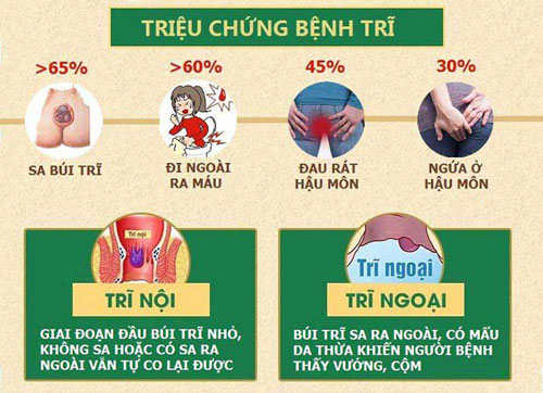 Dấu hiệu bệnh trĩ