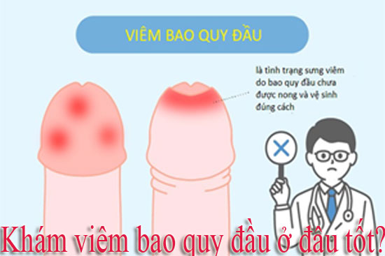 10 Địa chỉ khám viêm bao quy đầu ở đâu tốt nhất Hà Nội
