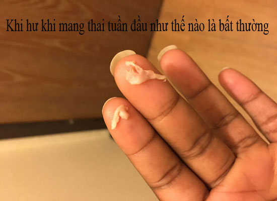 Khi hư khi mang thai tuần đầu như thế nào là bất thường