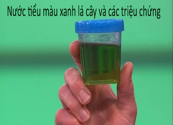 Nước tiểu màu xanh lá cây và các triệu chứng