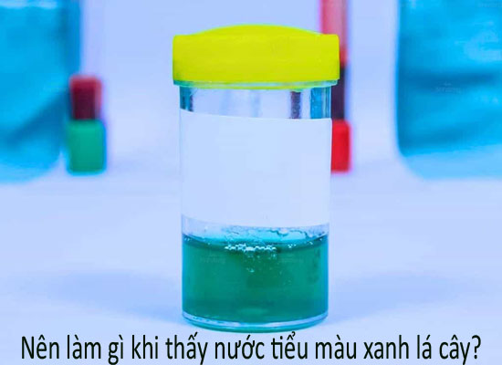 Nên làm gì khi thấy nước tiểu màu xanh lá cây?