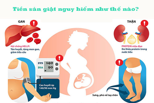 Tiền sản giật nguy hiểm như thế nào