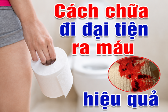 Cách chữa đi đại tiện ra máu hiệu quả