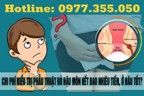 Chi phí phẫu thuật rò hậu môn hết bao nhiêu tiền?