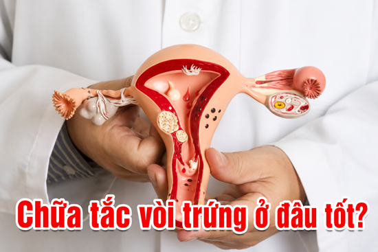 11 Địa chỉ chữa tắc vòi trứng ở đâu tốt nhất tại Hà Nội