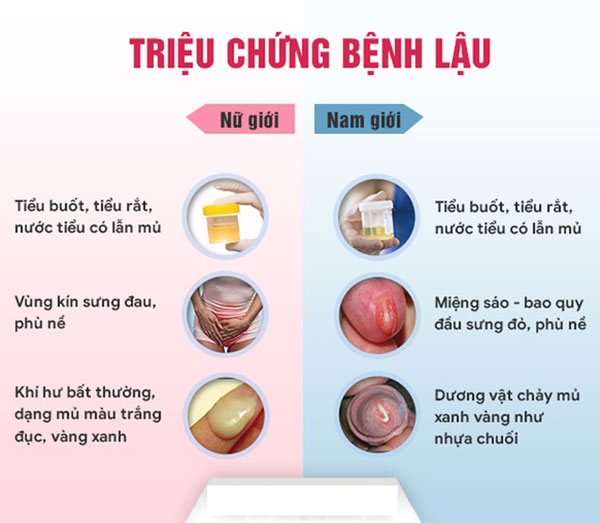 11 Dấu hiệu bệnh lậu ở nam và nữ giới thường gặp