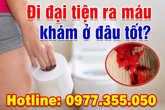 Đi cầu ra màu khám ở đâu tốt?