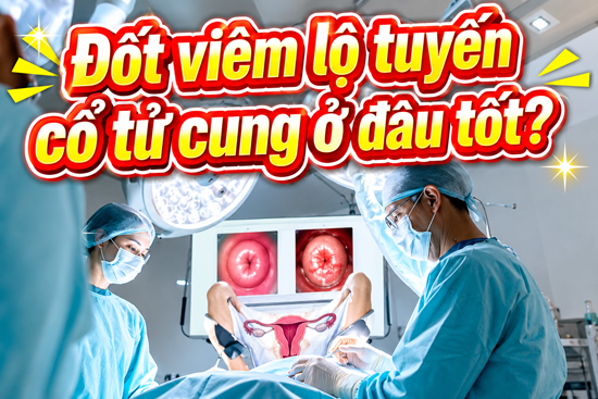 Địa chỉ đốt viêm lộ tuyến cổ tử cung ở đâu tốt nhất Hà Nội
