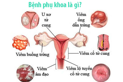 12 bệnh phụ khoa thường gặp ở chị em