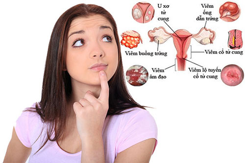 Các&nbsp;bệnh phụ khoa thường gặp ở phụ nữ hiện nay