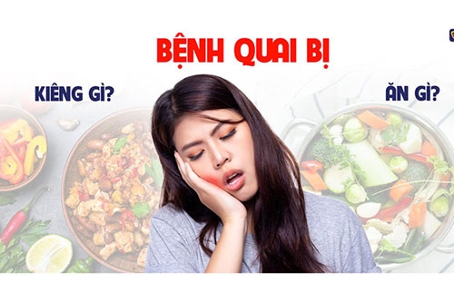 Bị quai bị kiêng gì?