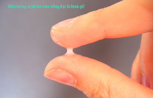 Hiện tượng ra khí hư màu trắng đục là bệnh gì