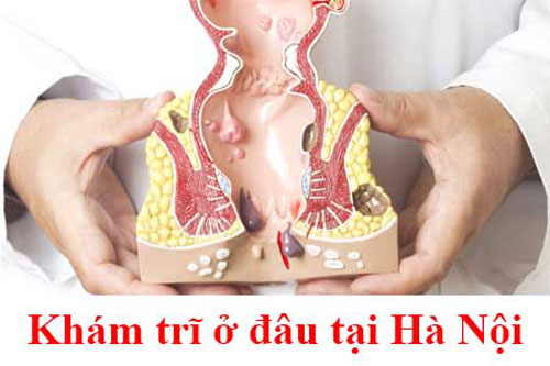 14 Địa chỉ phòng khám chữa bệnh trĩ ở đâu tốt nhất Hà Nội