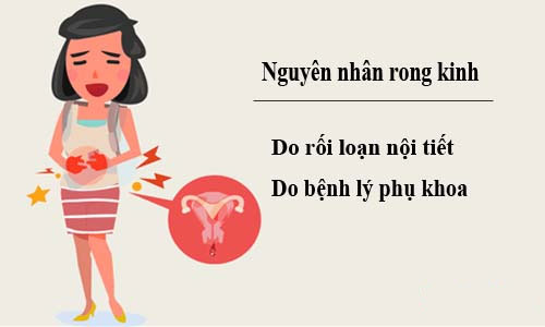 Nguyên nhân gây rong kinh