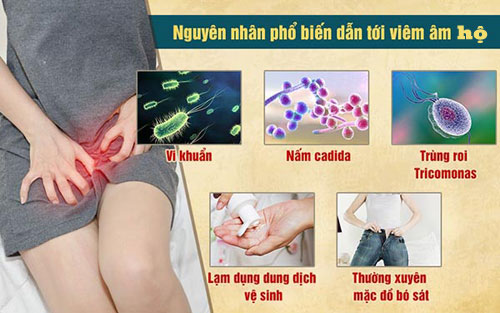 Nguyên nhân gây viêm âm hộ