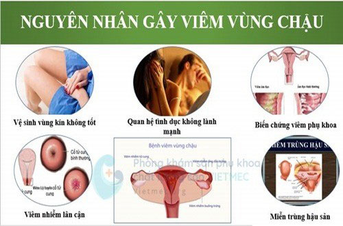 Nguyên nhân và triệu chứng viêm vùng chậu