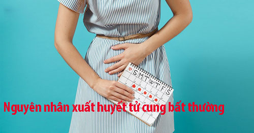 Nguyên nhân xuất huyết tử cung bất thường