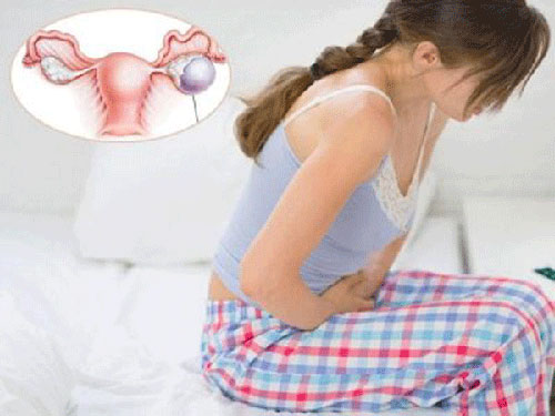 Suy buồng trứng Suy buồng trứng