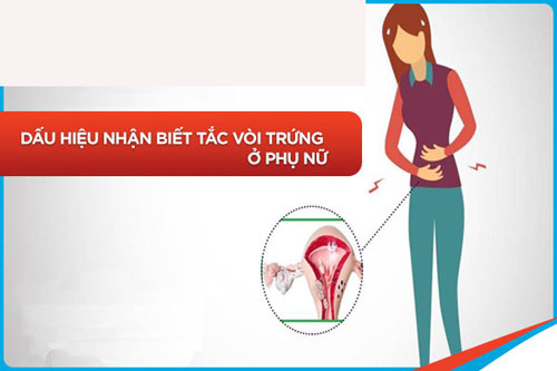 Triệu chứng tắc vòi trứng