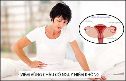 Viêm vùng chậu có nguy hiểm không