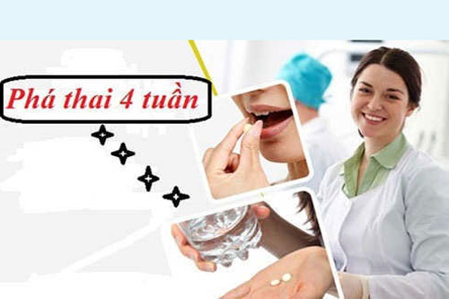 Phá thai 4 tuần tuổi (1 tháng) có tội không?