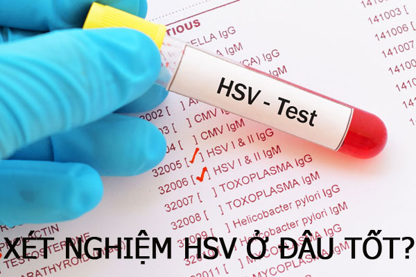 Xét nghiệm HSV ở đâu? 10 địa chỉ uy tín tại Hà Nội